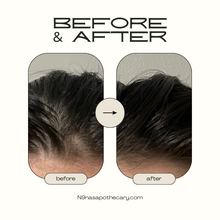 Load image into Gallery viewer, Hair Growth Serum (1oz)